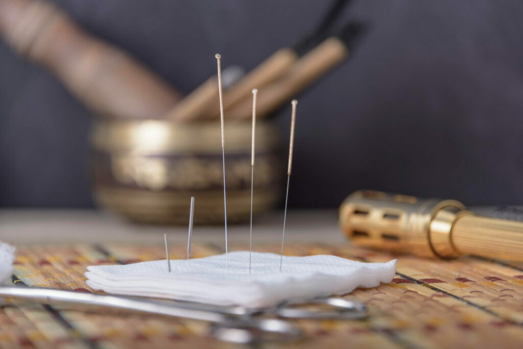 Acupuncture Treatment
