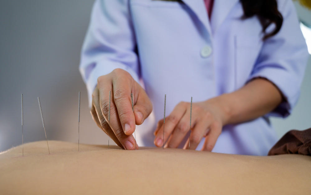 acupuncture therapy dublin